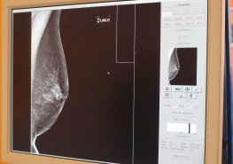 Mamocentrum Svitavy přijímá poukázky na vyšetření prsu