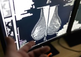 Mamocentrum Svitavy přijímá poukázky na vyšetření prsu