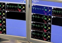 Ve Svitavské nemocnici byl dokončen projekt obnovy přístrojového vybavení