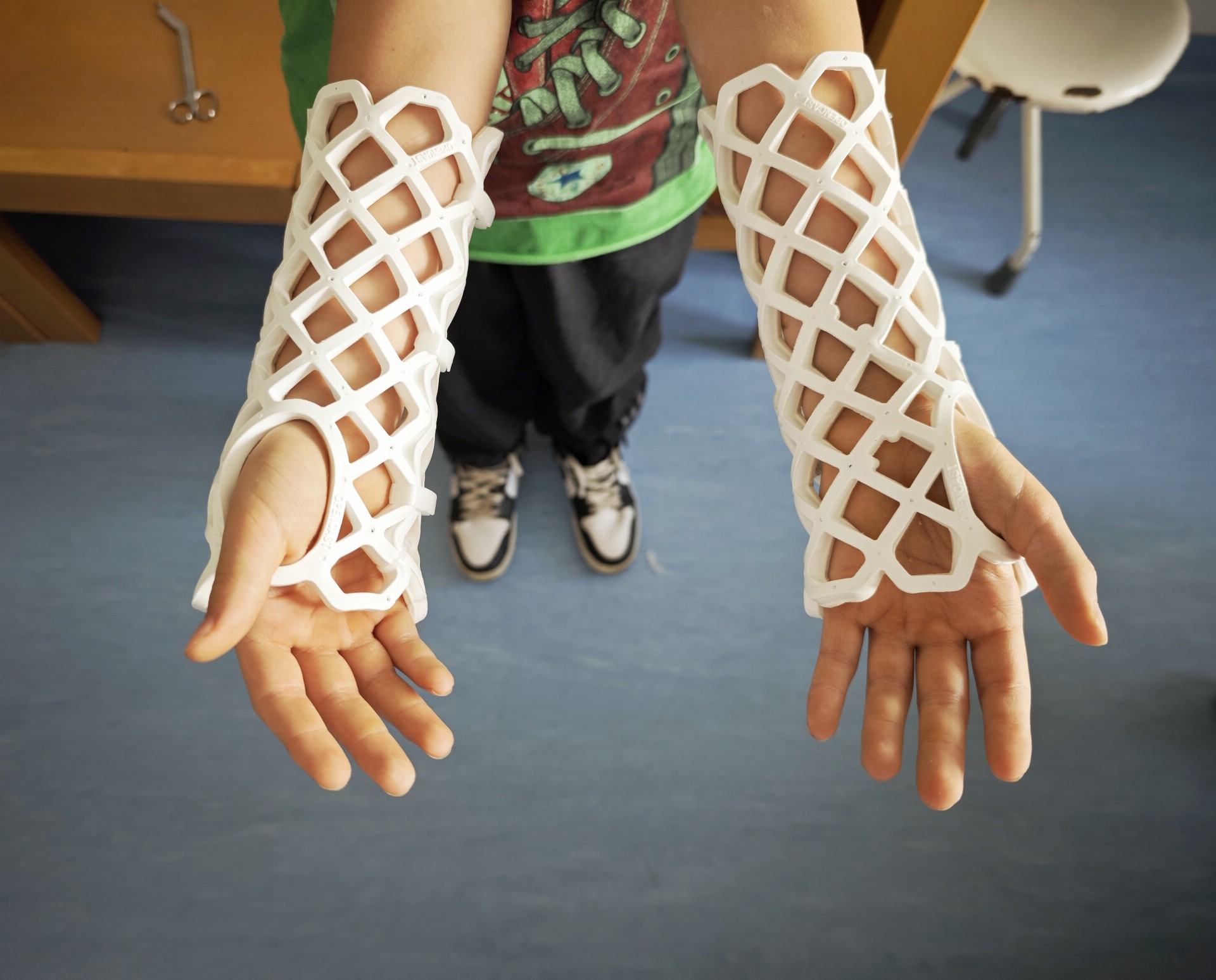 Ani sádra nemusí zkazit dovolenou. Její alternativa je dostupná i v našich nemocnicích