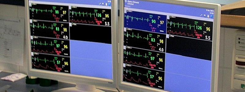 Ve Svitavské nemocnici byl dokončen projekt obnovy přístrojového vybavení